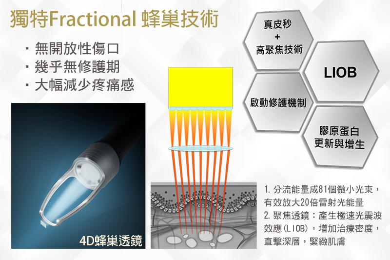 4D皮秒雷射優勢